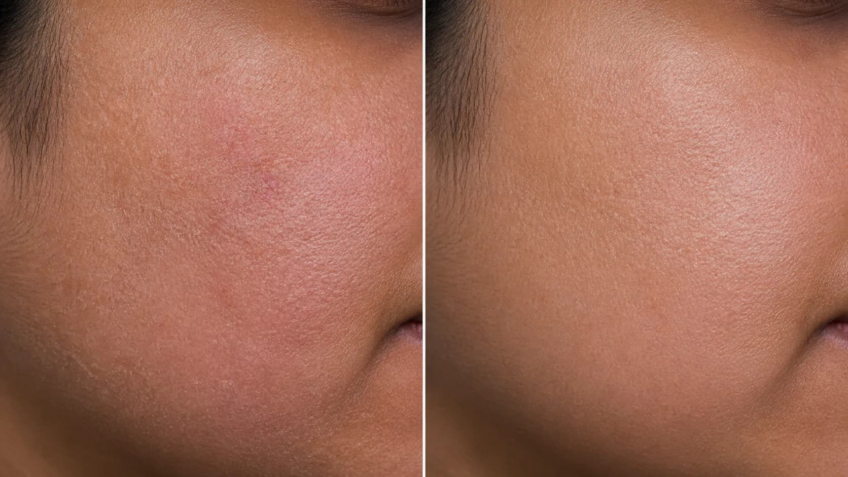 Rough dry patches before-and-after pair