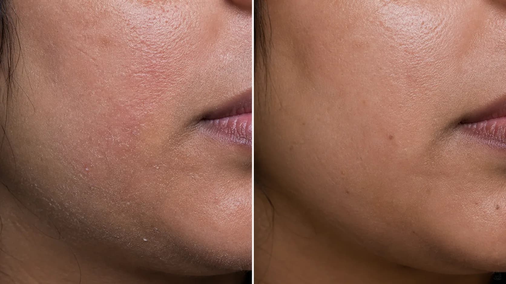 Compromised barrier before-and-after pair
