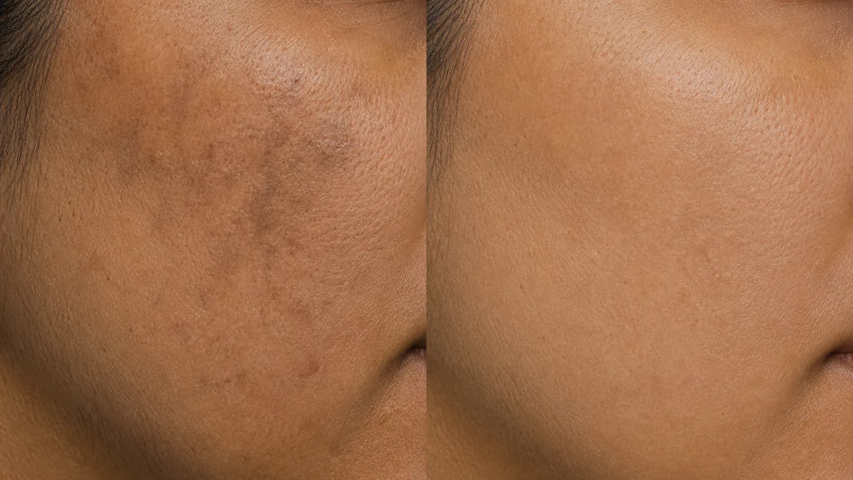 Dull uneven tone before-and-after pair