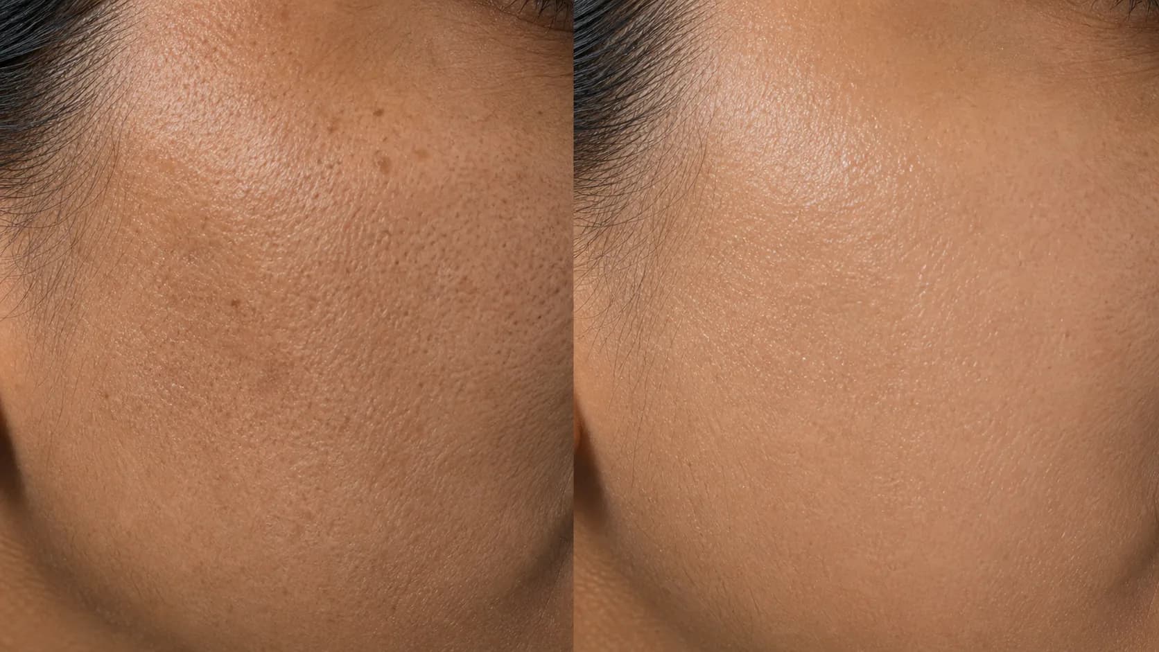 Early photoageing before-and-after pair