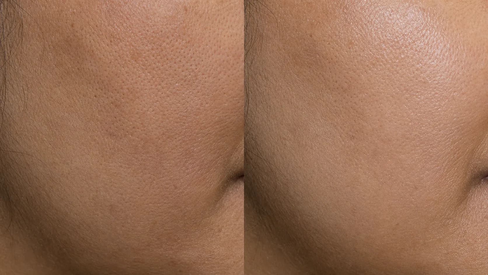Dullness and firmness before-and-after pair