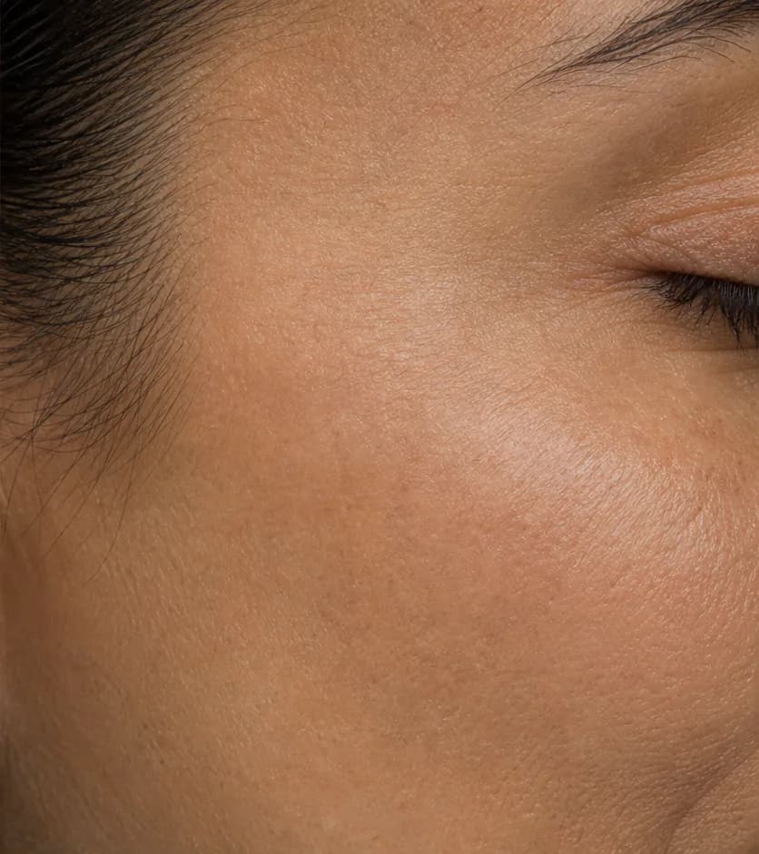 Fine lines and texture — Week 12